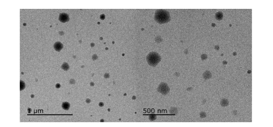 视黄醇棕榈酸酯醇质体透射电镜图 视黄醇棕榈酸酯醇质体透射电镜图