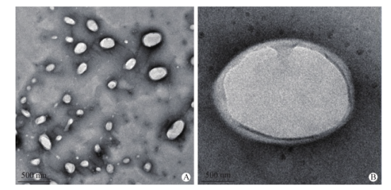 透射电镜观察布替萘芬醇质体形态( A: 20 000X ; B: 200 000X )