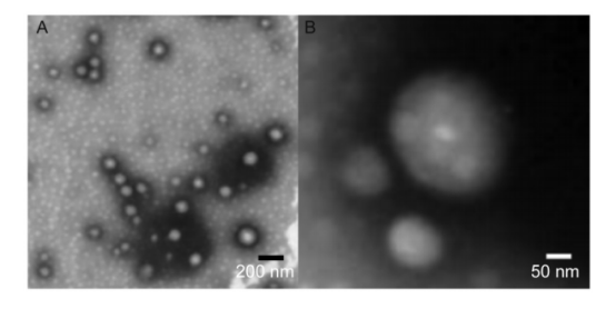 倍他司汀醇质体的电镜照片